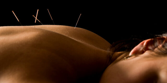 Acupuncture for Addiction: A Natural Path to Recovery